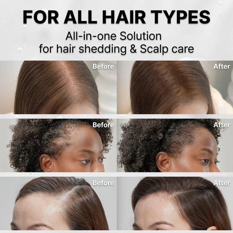 Lilyeve GROWTURN™ Advanced Hair Growth Serum