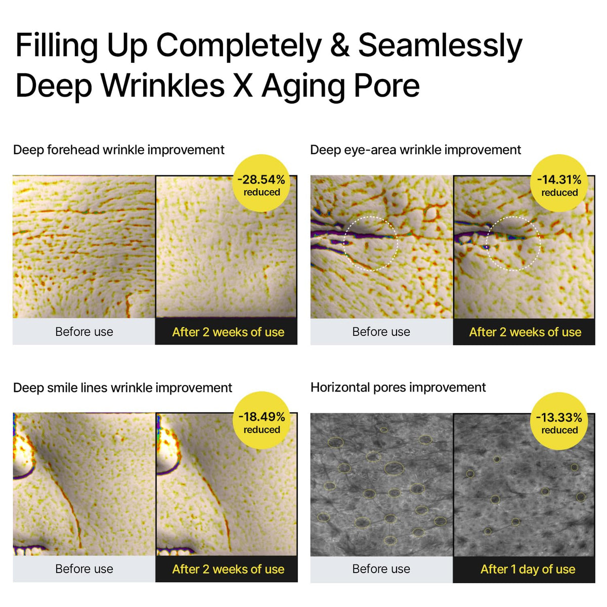 Botox & Retinol Shot - Eraser for Deep Wrinkles, Sagging Jowls & Puffy Eyes