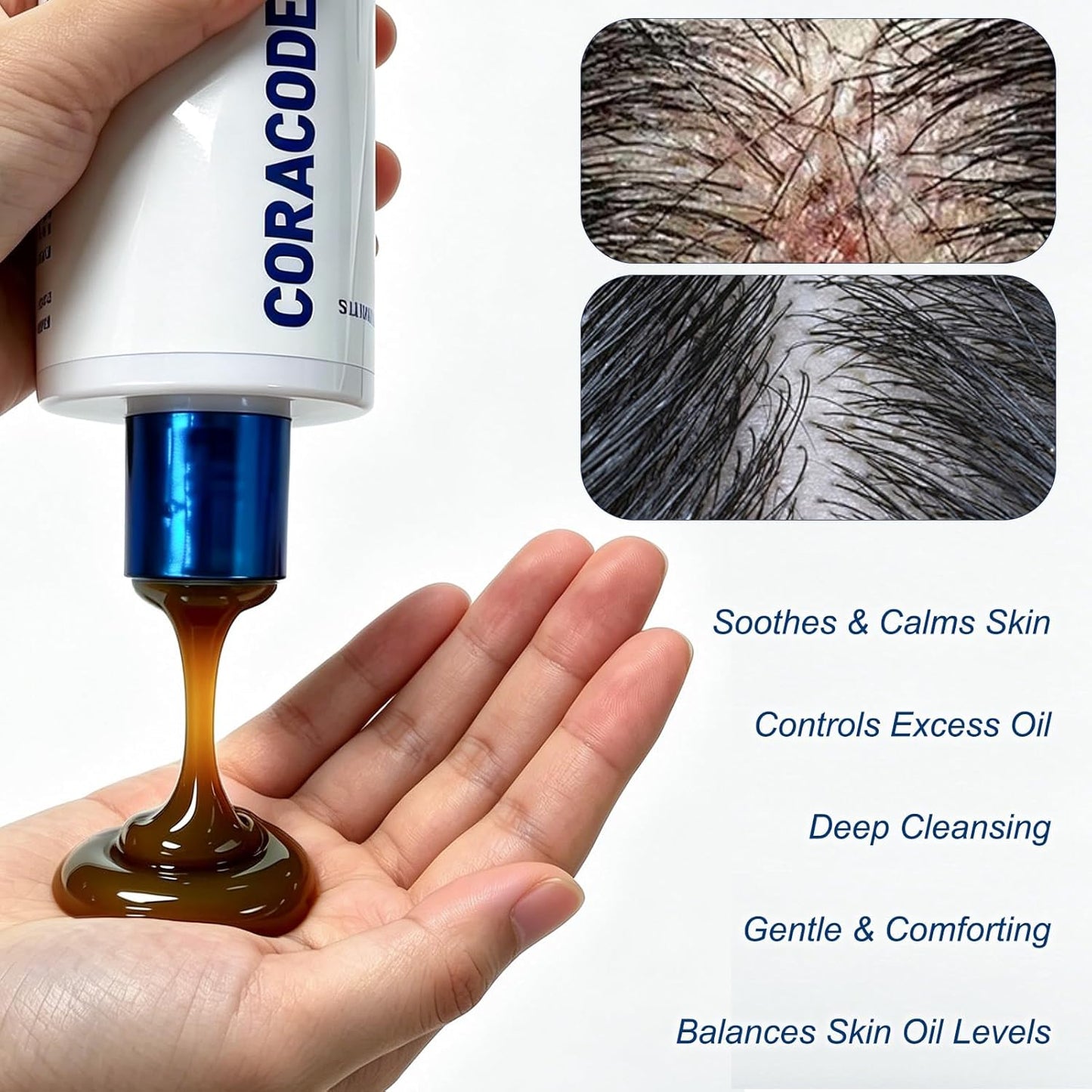 Coracode™ Follicle Care Shampo & Anti-Dandruff Care