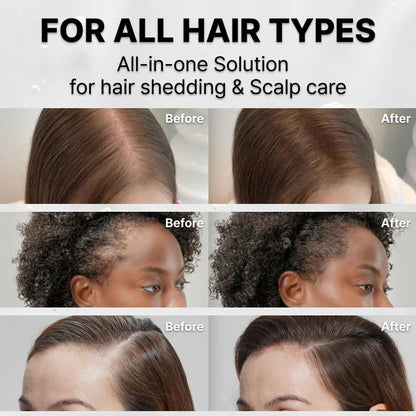 Lilyeve GROWTURN™ Advanced Hair Growth Serum
