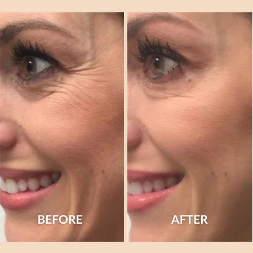 Silicone Scar Sheets