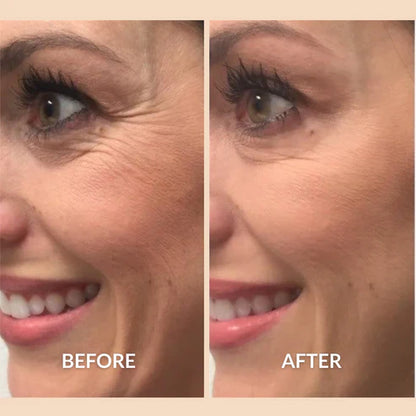 Silicone Scar Sheets