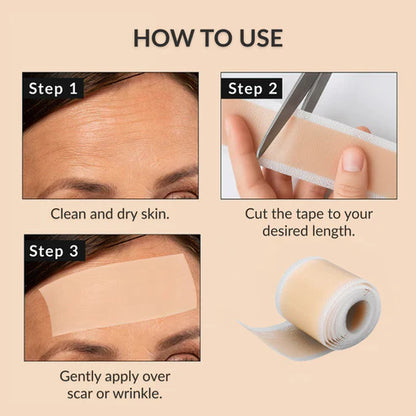Silicone Scar Sheets
