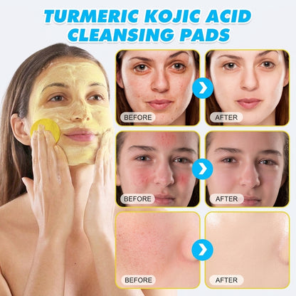 Turmeric & Kojic Acid Glow Cleansing Pads