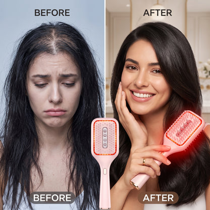 GlowUp LED Scalp Brush – Less Hair Fall, More Fullness