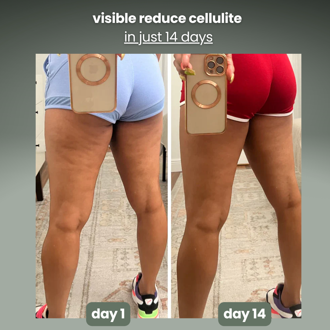 Anti-Cellulite Roller & massager