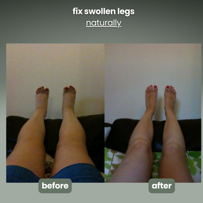 Anti-Cellulite Roller & massager
