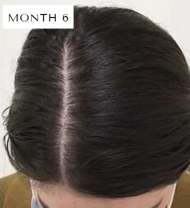 Red Light Scalp Therapy Brush Hair Growth Care