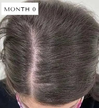 Red Light Scalp Therapy Brush Hair Growth Care